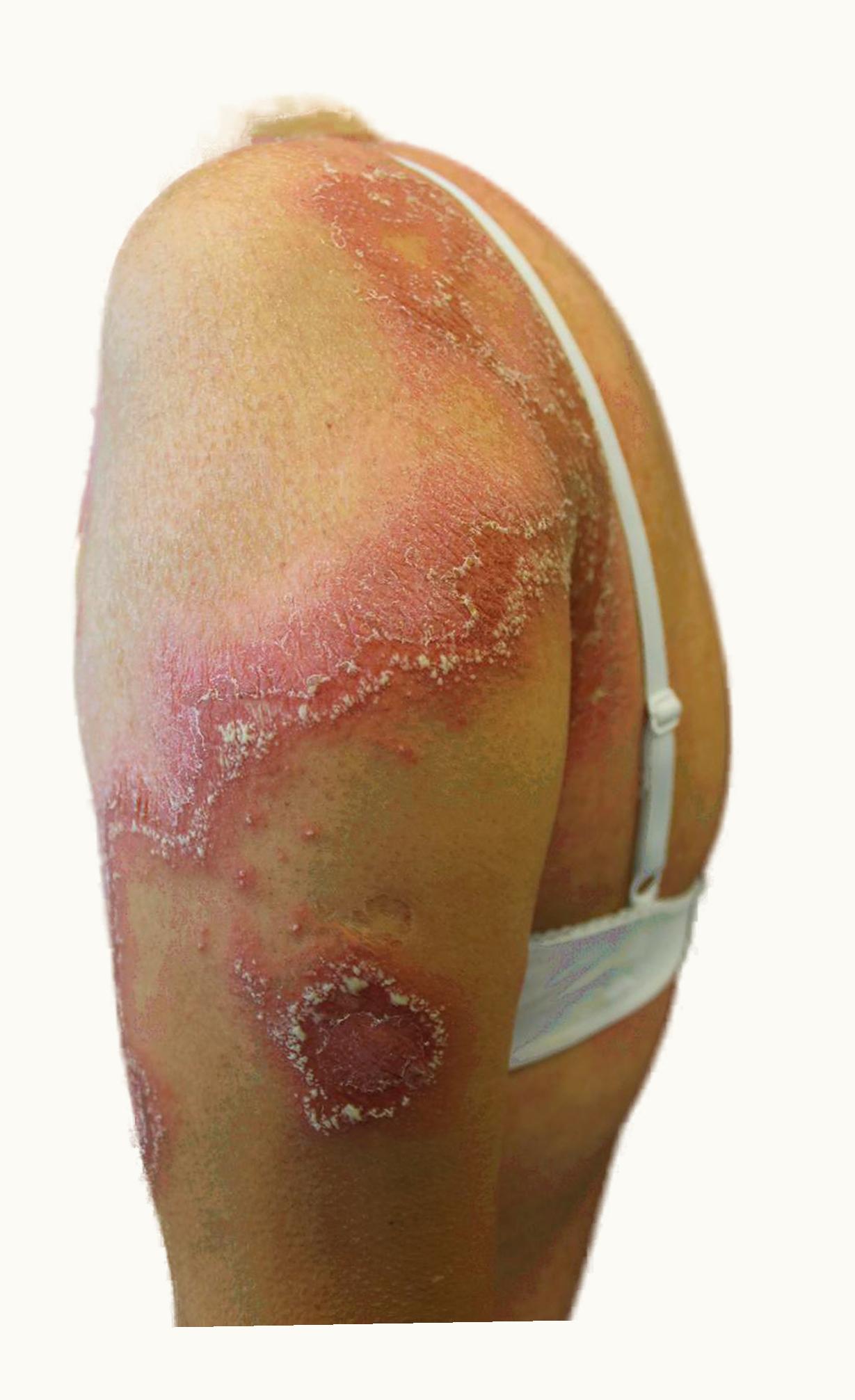 Vacheron Constantin Traditionnelle Hand Wound Bracelet